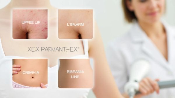 Pourquoi le prix de l'épilation laser varie selon les zones traitées ?